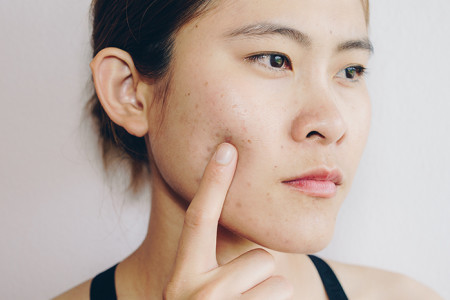 A young woman touching her face