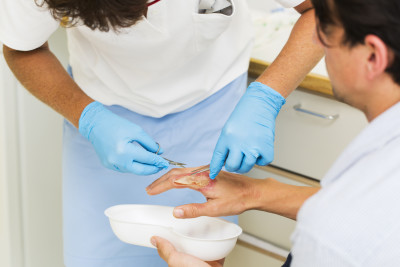 Nurse taking care of mans index finger after burn wound