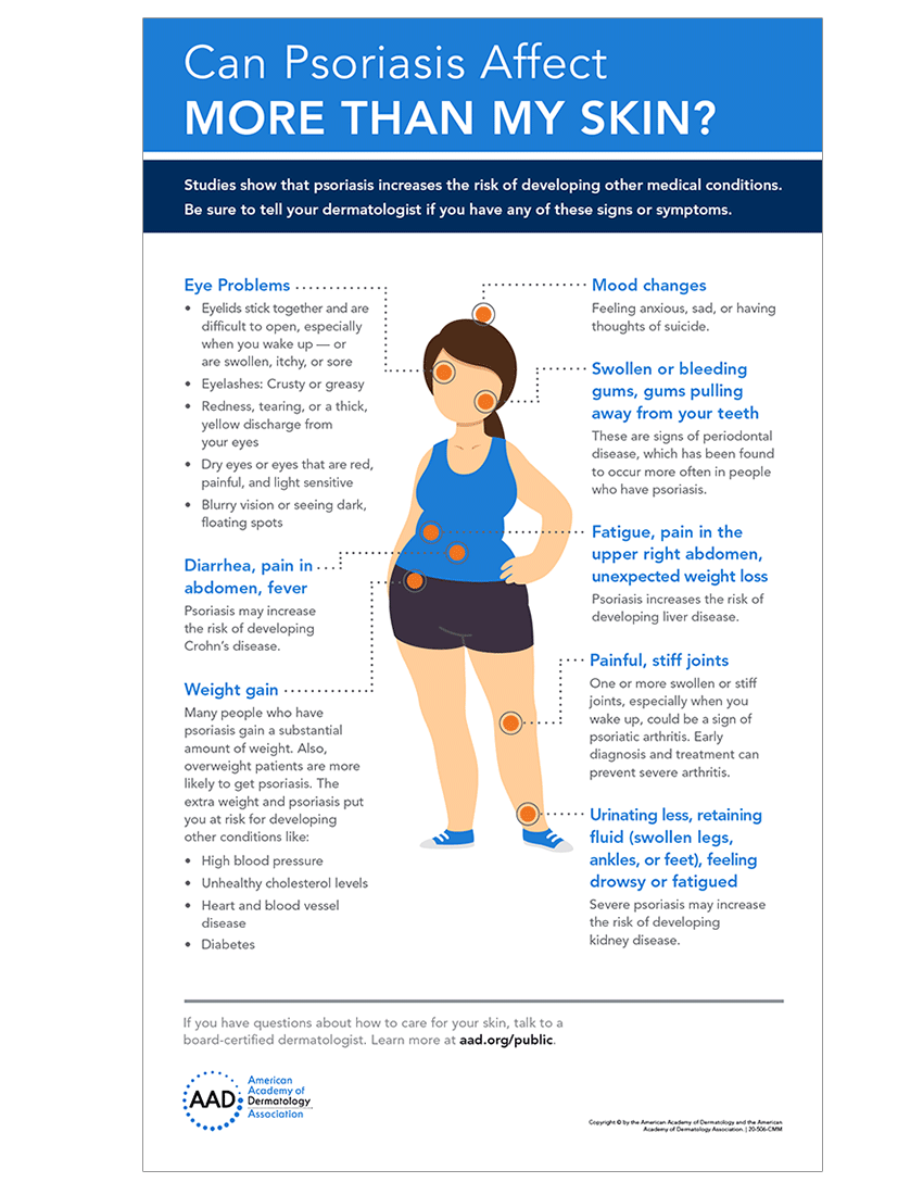 Infographic: Psoriasis related medical conditions