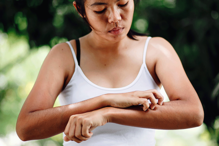 Woman scratching itchy patch of neurodermatitis.