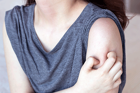 Girl scratching the itch on her arm with hand