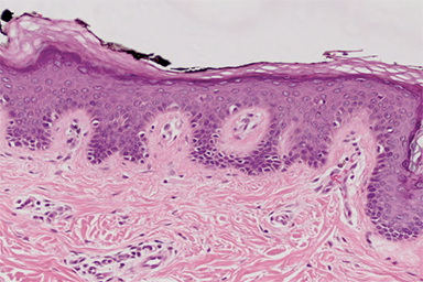 Basement Membrane cell image