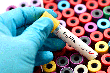 Blood sample positive with syphilis