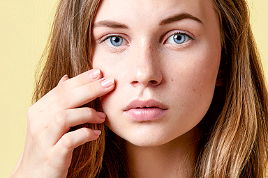 Teen touching acne on face